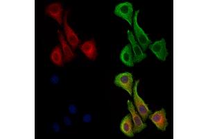 ABIN7094416 and ABIN7098463 staining Hela cells by IF/ICC.