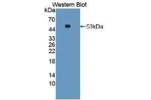 Detection of Recombinant IL6, Rabbit using Monoclonal Antibody to Interleukin 6 (IL6) (IL-6 antibody  (AA 27-241))