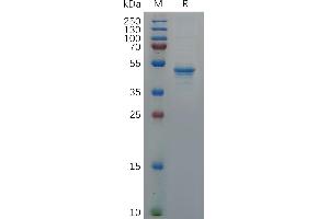 GDNF Protein (AA 78-211) (Fc Tag)