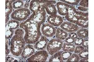 Image no. 1 for anti-Tripartite Motif Containing 44 (TRIM44) antibody (ABIN1501505) (TRIM44 antibody)