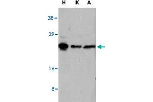 Western blot analysis of NOL3 in HeLa (H), KB (K), and A-549 (A) whole cell lysates with NOL3 polyclonal antibody  at 1 : 1000 dilution. (NOL3 antibody  (AA 191-208))