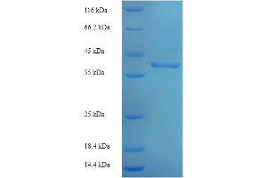 SDS-PAGE (SDS) image for CINP (CINP) (AA 1-212), (full length) protein (His-SUMO Tag) (ABIN4975683) (CINP Protein (CINP) (AA 1-212, full length) (His-SUMO Tag))