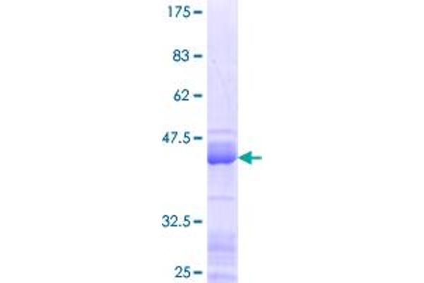 HMGA1 Protein (AA 1-107) (GST tag)