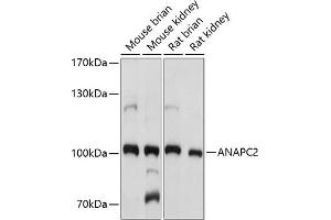 Western blot analysis of extracts of various cell lines, using  antibody (ABIN7265581) at 1:1000 dilution. (ANAPC2 antibody  (AA 400-500))