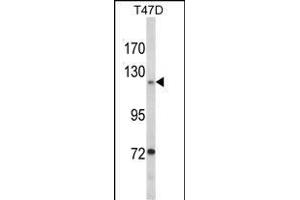 Western blot analysis of PTK2 Antibody (Center) (ABIN1882121 and ABIN2842373) in T47D cell line lysates (35 μg/lane). (FAK antibody  (AA 396-423))