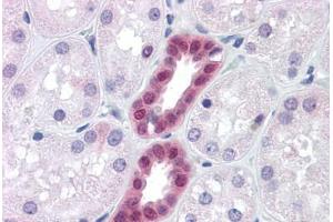 Human Kidney: Formalin-Fixed, Paraffin-Embedded (FFPE) (PAX2A antibody  (AA 194-304))