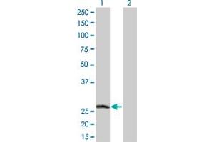 Western Blot analysis of PSPH expression in transfected 293T cell line by PSPH monoclonal antibody (M01A), clone 3A5. (PSPH antibody  (AA 1-225))
