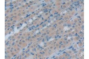 IHC-P analysis of Rat Intestine Tissue, with DAB staining. (HSPH1 antibody  (AA 595-733))