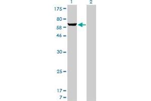 Western Blot analysis of PAPSS1 expression in transfected 293T cell line by PAPSS1 monoclonal antibody (M05), clone 1F4.