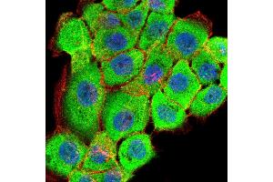 Immunofluorescence analysis of A431 cells using RPS6KA2 mouse mAb (green).