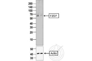 Image provided by the Independent Validation Program (badge number 29805). (FZD7 antibody  (AA 501-574))