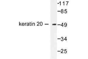 Image no. 1 for anti-Keratin 20 (KRT20) antibody (ABIN265500) (KRT20 antibody)