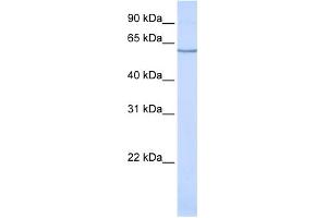 WB Suggested Anti-SLC1A1 Antibody Titration:  0.
