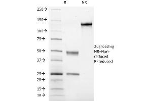 SDS-PAGE Analysis Purified CD41a Mouse Monoclonal Antibody (ITGA2B/1036). (Integrin Alpha2b antibody)