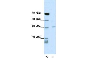 WB Suggested Anti-CACNB4 Antibody Titration:  0. (CACNB4 antibody  (C-Term))