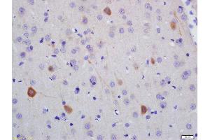 Formalin-fixed and paraffin embedded rat brain labeled with Anti-NF-H Polyclonal Antibody, Unconjugated  at 1:200 followed by conjugation to the secondary antibody and DAB staining (NEFH antibody  (AA 21-120))