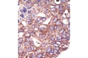 Image no. 2 for anti-Synovial Apoptosis Inhibitor 1, Synoviolin (SYVN1) (C-Term) antibody (ABIN357625) (SYVN1 antibody  (C-Term))