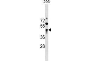 ZBTB32 Antibody (N-term) western blot analysis in 293 cell line lysates (35 µg/lane).