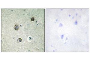Immunohistochemistry (IHC) image for anti-Cyclin-Dependent Kinase 5 (CDK5) (Tyr15) antibody (ABIN1848071) (CDK5 antibody  (Tyr15))