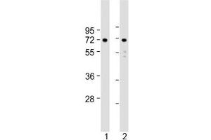Western blot testing of human 1) U-251 MG and 2) U-87 MG cell lysate with APLP1 antibody at 1:2000. (APLP1 antibody  (AA 505-539))