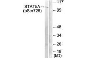 Western blot analysis of extracts from Jurkat cells treated with EGF 200ng/ml 30', using STAT5A/B (Phospho-Ser725/730) Antibody. (STAT5 A/B antibody  (pSer726))