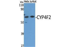 Western Blotting (WB) image for anti-Cytochrome P450, Family 4, Subfamily F, Polypeptide 2 (CYP4F2) (N-Term) antibody (ABIN3174669) (CYP4F2 antibody  (N-Term))