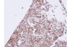 IHC-P Image Immunohistochemical analysis of paraffin-embedded DU145 xenograft, using GIRK1, antibody at 1:100 dilution. (KCNJ3 antibody  (Center))