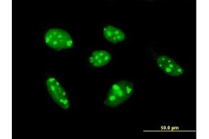 Immunofluorescence of purified MaxPab antibody to TSPYL1 on HeLa cell. (TSPYL1 antibody  (AA 1-438))