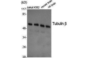 Western Blotting (WB) image for anti-Tubulin, beta (TUBB) (C-Term) antibody (ABIN3187378) (TUBB antibody  (C-Term))