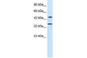 WB Suggested Anti-PNMA1 Antibody Titration:  0. (PNMA1 antibody  (Middle Region))