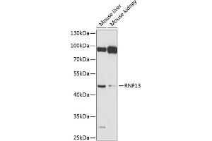 Western blot analysis of extracts of various cell lines, using RNF13 antibody (ABIN6128641, ABIN6147009, ABIN6147010 and ABIN6224394) at 1:1000 dilution. (RNF13 antibody  (AA 204-381))