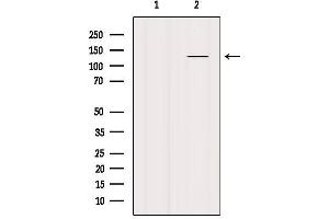 Western blot analysis of extracts from Mouse lung, using SMC3 Antibody. (SMC3 antibody  (C-Term))