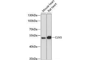Western blot analysis of extracts of various cell lines using CLN5 Polyclonal Antibody at dilution of 1:3000.