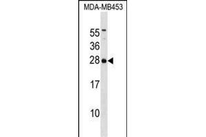IT Antibody (C-term) (ABIN1536735 and ABIN2850350) western blot analysis in MDA-M cell line lysates (35 μg/lane). (ITPA antibody  (C-Term))