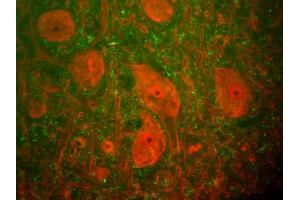 Rat spinal cord stained with anti-UCHL1(red) and anti-neurofilament NF-H antibody (1451-NFH)(green). (UCHL1 antibody)
