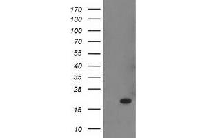 Western Blotting (WB) image for anti-Retinol Binding Protein 1, Cellular (RBP1) antibody (ABIN1497626) (RBP1 antibody)
