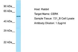 Host: Rabbit Target Name: CERK Sample Type: 721_B Whole Cell lysates Antibody Dilution: 1. (CERK antibody  (C-Term))
