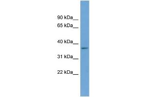WB Suggested Anti-BACE2  Antibody Titration: 0. (BACE2 antibody  (Middle Region))