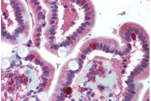Human Small Intestine (formalin-fixed, paraffin-embedded) stained with FPR1 antibody ABIN297066 at 10 ug/ml followed by biotinylated goat anti-rabbit IgG secondary antibody ABIN481713, alkaline phosphatase-streptavidin and chromogen. (FPR1 antibody  (AA 176-190))