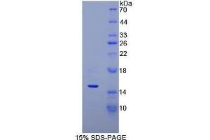 SDS-PAGE (SDS) image for Defensin, alpha 5, Paneth Cell-Specific (DEFA5) (AA 20-94) protein (His tag) (ABIN1170304)