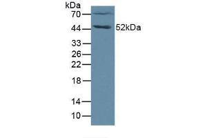 Western blot analysis of Human Jurkat Cells. (FGL2 antibody  (AA 20-432))