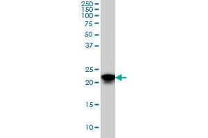 SFRS3 monoclonal antibody (M08), clone 2D2 Western Blot analysis of SFRS3 expression in HeLa . (SRSF3 antibody  (AA 1-85))