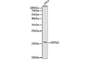 Western blot analysis of extracts of HeLa cells, using IFITM2 antibody (ABIN7267949) at 1:1000 dilution.