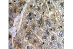 Used in DAB staining on fromalin fixed paraffin-embedded Liver tissue (MYB antibody  (AA 305-558))