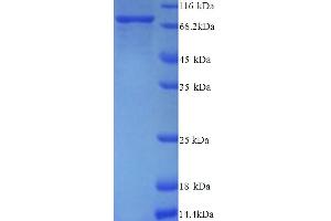 SDS-PAGE (SDS) image for Peptidyl Arginine Deiminase, Type II (PADI2) (AA 1-665), (full length) protein (His tag) (ABIN5714528) (PADI2 Protein (AA 1-665, full length) (His tag))