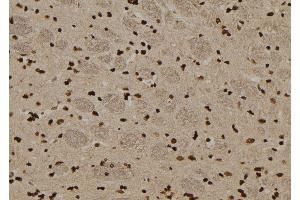 ABIN6276548 at 1/100 staining Rat brain tissue by IHC-P. (TRADD antibody  (N-Term))