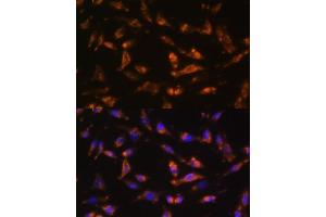 Immunofluorescence analysis of L929 cells using CSF2 antibody (ABIN6130426, ABIN6139094, ABIN6139095 and ABIN6221725) at dilution of 1:100. (GM-CSF antibody  (AA 18-144))