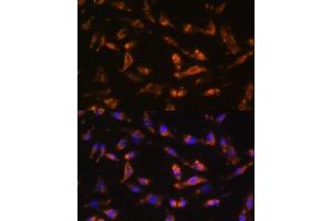 Immunofluorescence analysis of L929 cells using CSF2 antibody (ABIN6130426, ABIN6139094, ABIN6139095 and ABIN6221725) at dilution of 1:100. (GM-CSF antibody  (AA 18-144))