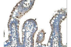 Image no. 1 for anti-Matrix Metallopeptidase 1 (Interstitial Collagenase) (MMP1) (AA 21-70) antibody (ABIN203491)