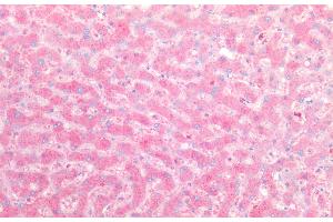 Immunohistochemistry of paraffin-embedded Human liver tissue using ORM2 Polyclonal Antibody at dilution of 1:100. (Orosomucoid 2 antibody)